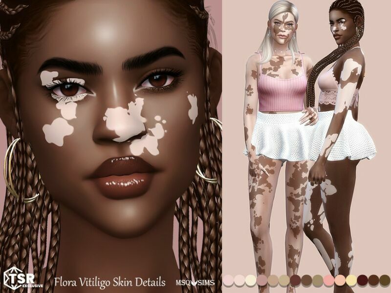 Flora Vitiligo Skin Details By Msqsims Sims 4 CC